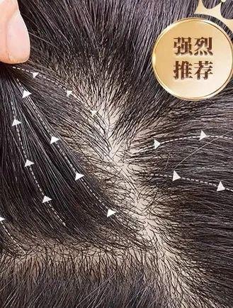 J9直营平台藏不住了！超逼真男士假发谁戴